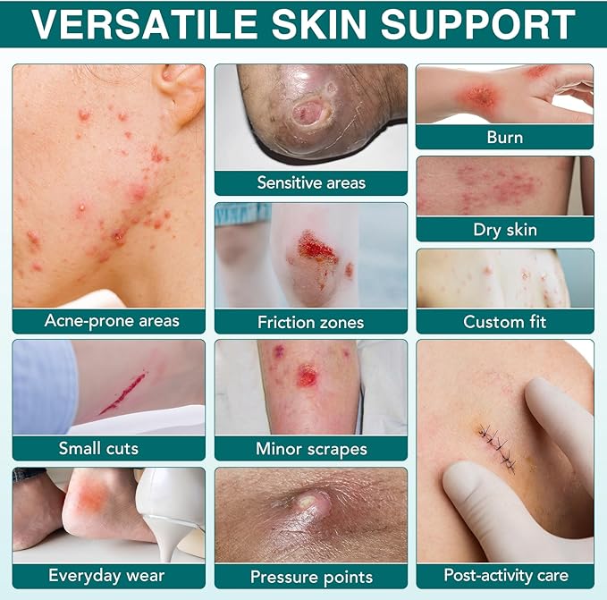 Hydrocolloid Bandages Roll for Wound Care, 5cm*3.6m Hydrocolloid Dressing Roll Cut-to-Size Plasters Supports Natural Healing, Ultra Absorption Waterproof Dressing Tape for Blisters, Acne, Minor Wounds