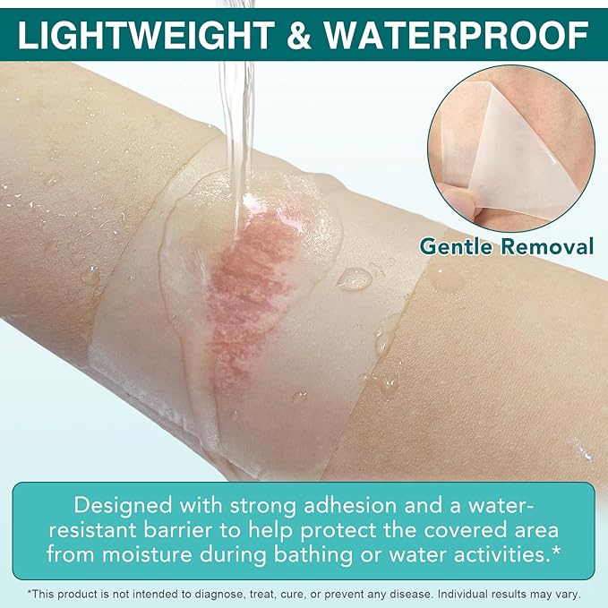 Hydrocolloid Bandages Roll for Wound Care, 5cm*3.6m Hydrocolloid Dressing Roll Cut-to-Size Plasters Supports Natural Healing, Ultra Absorption Waterproof Dressing Tape for Blisters, Acne, Minor Wounds