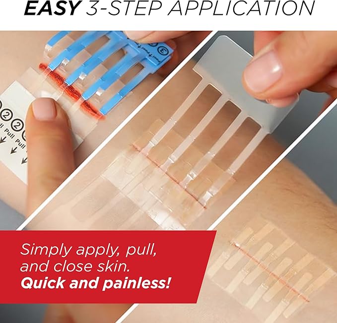 Clozex Emergency Laceration Closure Only- Close Wounds Without Stitches with This Surgical-Grade Skin Device. Available in 3 Variations for Wounds up to 1.0” or 3.5”. Life Happens, Be Ready!