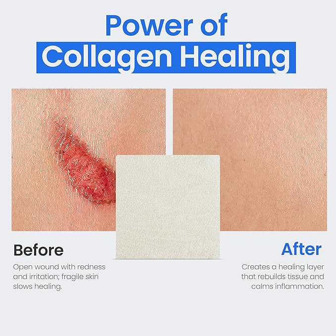 Collagen Dressing Pads - 2" x 2" 5 Count Collagen Pads for Wounds - Non-Adherent Collagen Dressing for Wound Care - Safe n' Simple Wound Care Supplies