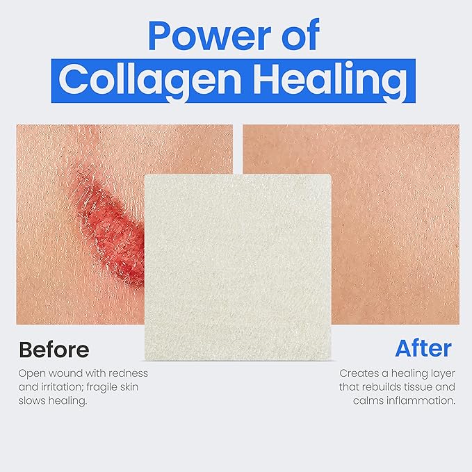 Collagen Dressing Pads - 4" x 4" 5 Count Collagen Pads for Wounds - Non-Adherent Collagen Dressing for Wound Care - Safe n' Simple Wound Care Supplies.