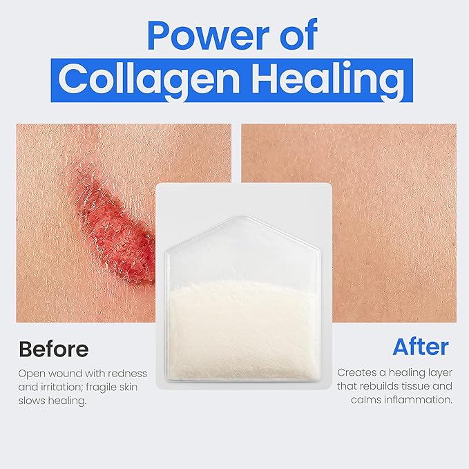 Collagen Dressing Powder for Wounds - 1 Gram - Box of 10 Collagen Packets - Collagen Wound Dressing Pads Powder - Safe n' Simple Wound Care Supplies