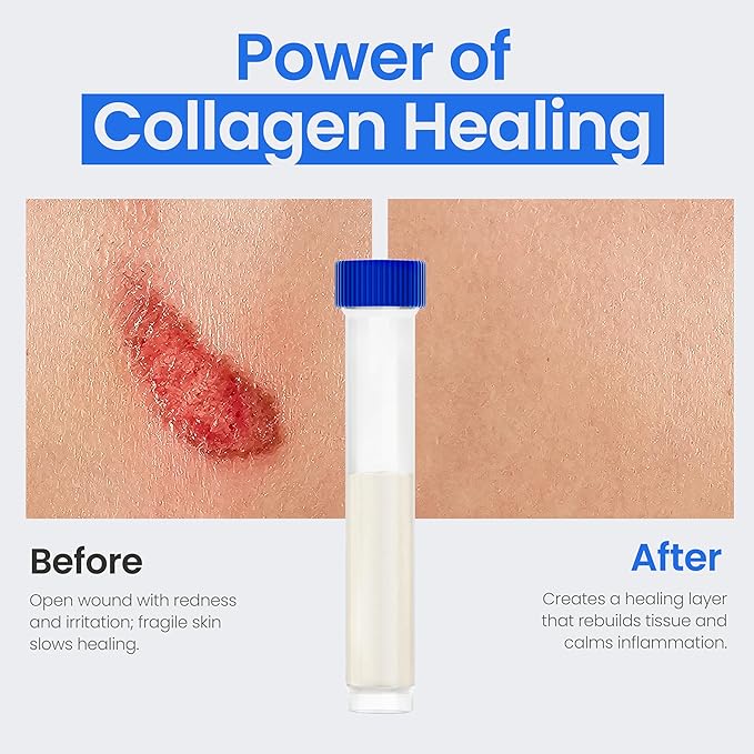 Powdered Collagen Wound Dressing - Box of Powder Vial 1g, 5 Pack - Wound Healing Supplement in Vials - Healing Collagen Dressing for Wounds - Powder Collagen Wound Healing Supplements